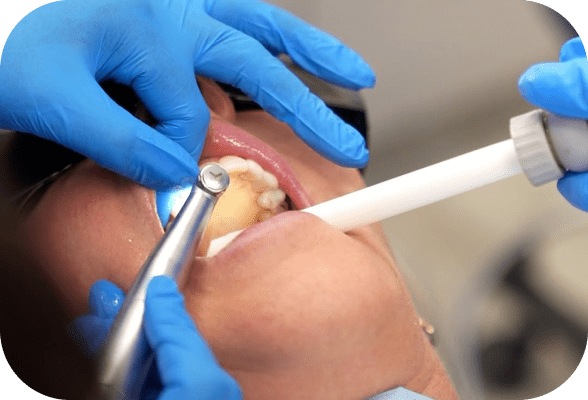 Dental Emergencies