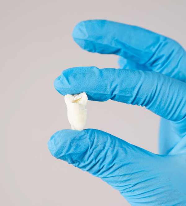 Treatment - Kent Emergency Dentist